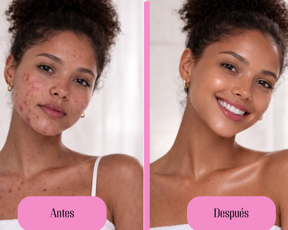 Limpiador facial 5 en 1